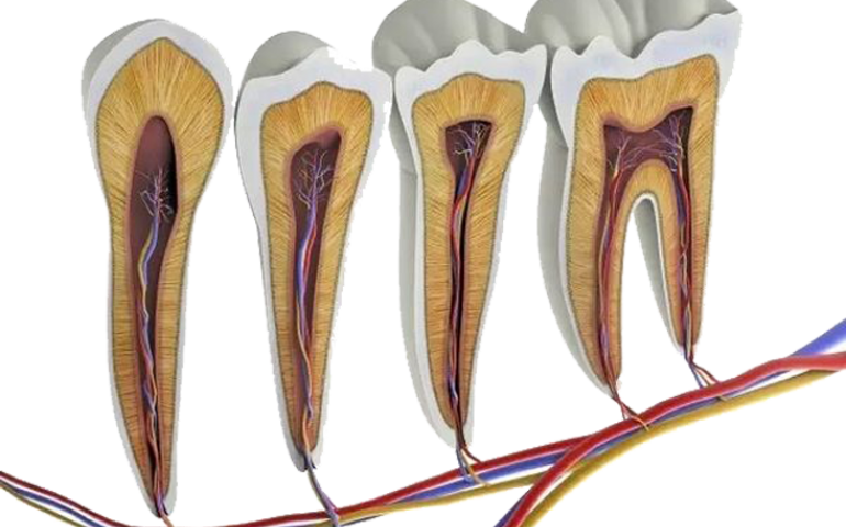 dent11