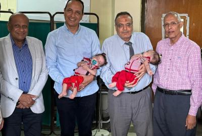 A new achievement for Assiut University in a rare operation to separate conjoined twins at the University Children's Hospital