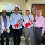 A new achievement for Assiut University in a rare operation to separate conjoined twins at the University Children's Hospital